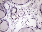 NUDT21 Antibody in Immunohistochemistry (Paraffin) (IHC (P))