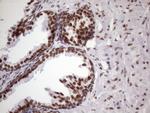 NUDT21 Antibody in Immunohistochemistry (Paraffin) (IHC (P))