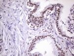 NUDT21 Antibody in Immunohistochemistry (Paraffin) (IHC (P))