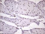 NUDT21 Antibody in Immunohistochemistry (Paraffin) (IHC (P))