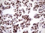 NUDT21 Antibody in Immunohistochemistry (Paraffin) (IHC (P))