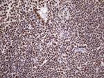 NUDT21 Antibody in Immunohistochemistry (Paraffin) (IHC (P))