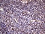 NUDT21 Antibody in Immunohistochemistry (Paraffin) (IHC (P))