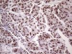 NUDT21 Antibody in Immunohistochemistry (Paraffin) (IHC (P))