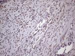 NUDT21 Antibody in Immunohistochemistry (Paraffin) (IHC (P))