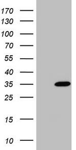 NUDT21 Antibody in Western Blot (WB)