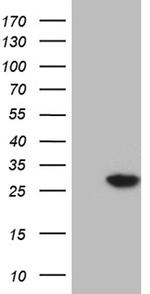 NUDT4 Antibody in Western Blot (WB)
