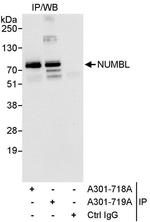 NUMBL Antibody in Immunoprecipitation (IP)