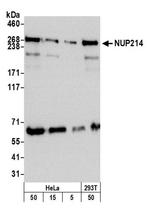 NUP214 Antibody in Western Blot (WB)