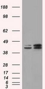 NXNL2 Antibody in Western Blot (WB)