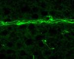 ZO-1 Antibody in Immunohistochemistry (IHC)