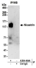Nicastrin Antibody in Western Blot (WB)