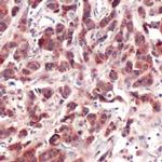 p70 S6 Kinase Antibody in Immunohistochemistry (IHC)