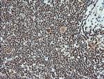 Notch1 Antibody in Immunohistochemistry (Paraffin) (IHC (P))