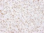 Nucleolin/NCL Antibody in Immunohistochemistry (IHC)