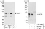 ODF2 Antibody in Western Blot (WB)