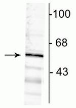 GABRA6 Antibody in Western Blot (WB)