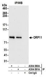 ORP11 Antibody in Western Blot (WB)