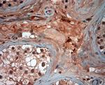 ATG4D Antibody in Immunohistochemistry (Paraffin) (IHC (P))