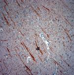 ATG4D Antibody in Immunohistochemistry (Paraffin) (IHC (P))