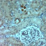 AQP6 Antibody in Immunohistochemistry (Paraffin) (IHC (P))