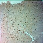 ARX Antibody in Immunohistochemistry (Paraffin) (IHC (P))