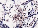 OSBPL11 Antibody in Immunohistochemistry (Paraffin) (IHC (P))