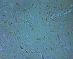 Phospho-ERK1/2 (Thr202, Tyr204) Antibody in Immunohistochemistry (Paraffin) (IHC (P))