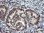 OSGEP Antibody in Immunohistochemistry (Paraffin) (IHC (P))