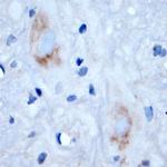 RAB4B Antibody in Immunohistochemistry (Paraffin) (IHC (P))