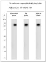 TRPA1 Antibody in Western Blot (WB)