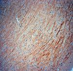 TrkB Antibody in Immunohistochemistry (Paraffin) (IHC (P))