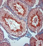 TRPM8 Antibody in Immunohistochemistry (Paraffin) (IHC (P))