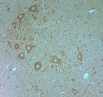 VPS34 Antibody in Immunohistochemistry (Paraffin) (IHC (P))