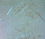 VPS34 Antibody in Immunohistochemistry (Paraffin) (IHC (P))