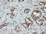 OTUB1 Antibody in Immunohistochemistry (Paraffin) (IHC (P))