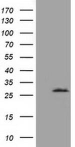 OTUB2 Antibody in Western Blot (WB)