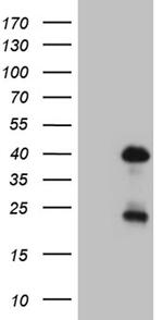 OTX2 Antibody in Western Blot (WB)