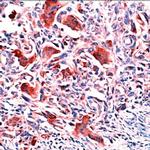 Osteopontin Antibody in Immunohistochemistry (IHC)