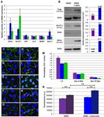 P-Glycoprotein Antibody in Western Blot (WB)