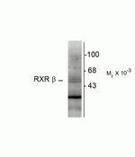 RXRB Antibody in Western Blot (WB)