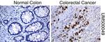 P53 Antibody in Immunohistochemistry (Paraffin) (IHC (P))