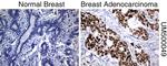 P53 Antibody in Immunohistochemistry (Paraffin) (IHC (P))