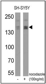 Phospho-nNOS (Ser1417) Antibody in Western Blot (WB)