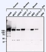 EGFR Antibody in Western Blot (WB)