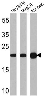 SOD2 Antibody in Western Blot (WB)