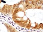 NTHL1 Antibody in Immunohistochemistry (Paraffin) (IHC (P))