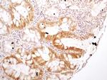 NTHL1 Antibody in Immunohistochemistry (Paraffin) (IHC (P))