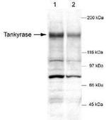 Tankyrase Antibody in Western Blot (WB)