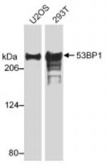 53BP1 Antibody in Western Blot (WB)